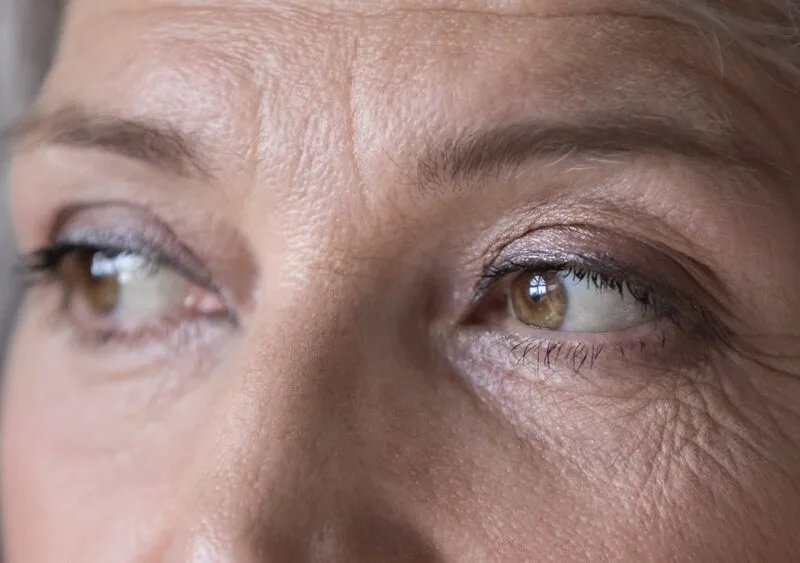 What are Cataracts? 4 Types and Their Symptoms