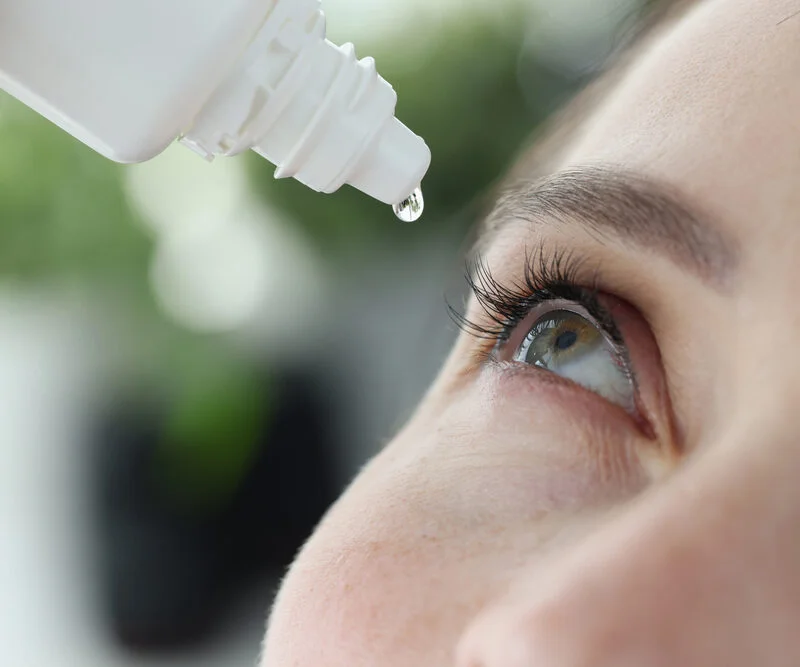 Woman dripping into her eyes with antibacterial drops closeup - Dry eye treatment